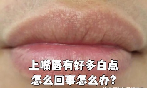 产妇月子里可以使用痔疮药膏吗-月子期间有痔疮能用药吗网 :分享月子期间痔疮犯了能擦药吗-产妇痔疮严重月子期间用什么药知识